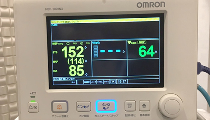 術中は必ずモニタリングして施術を行います